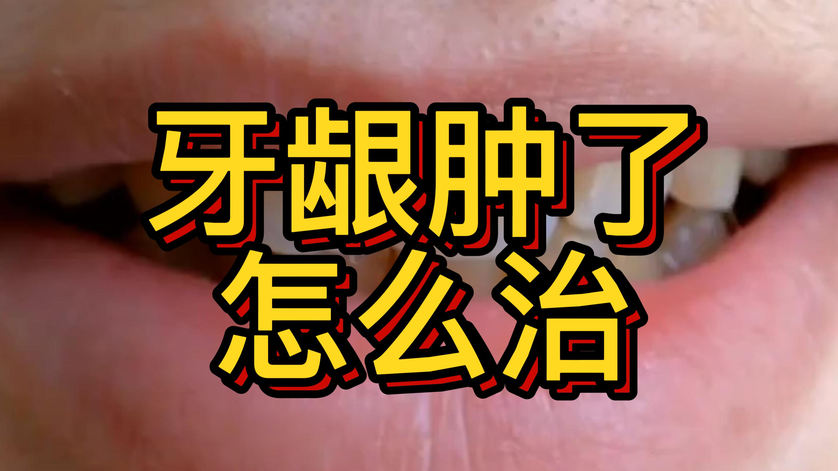 牙龈肿了怎么治?