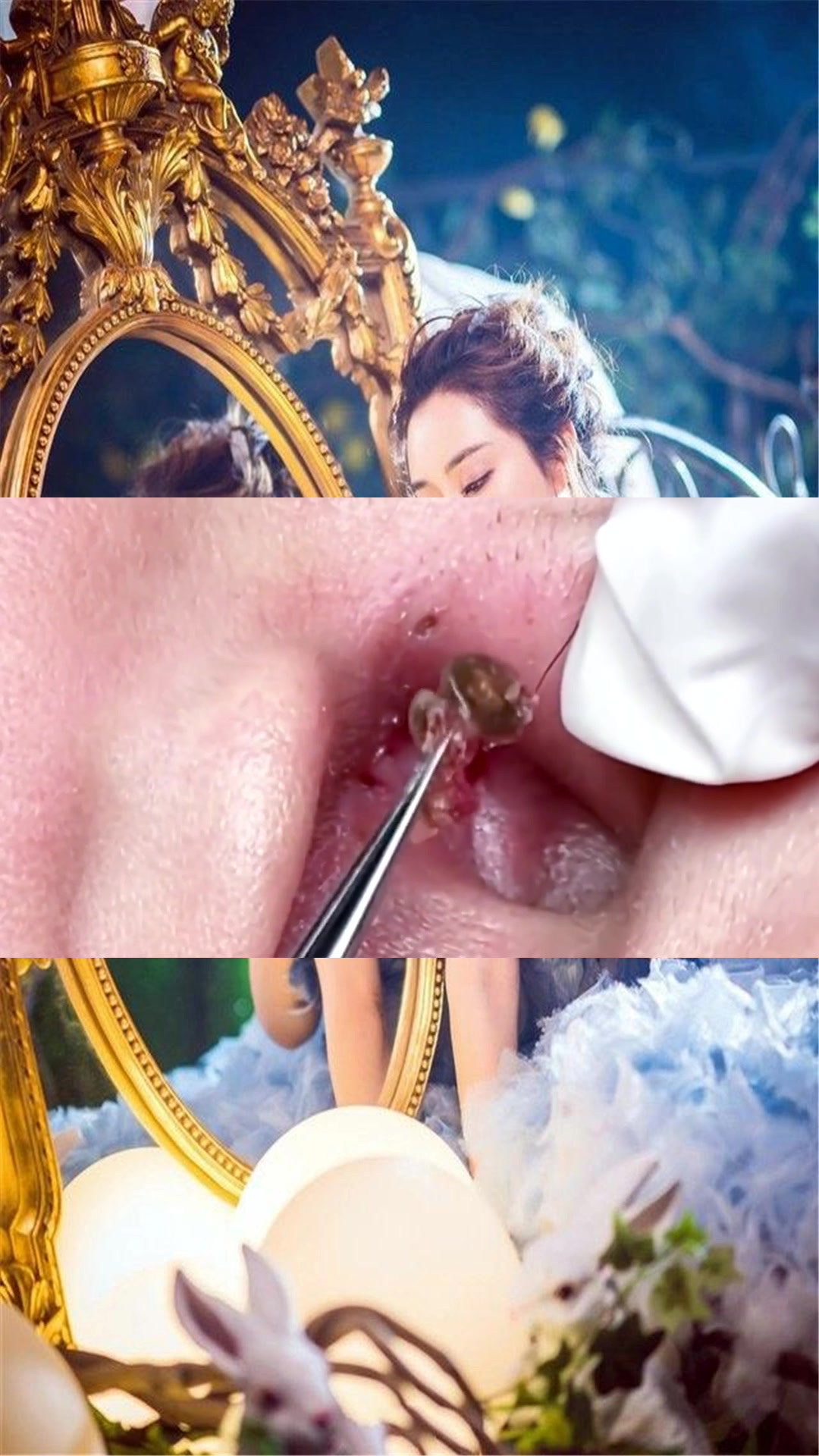 用手挤黑头危害太大,推荐你们看看这个,轻松高效