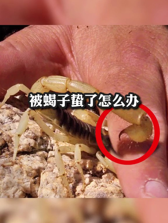 冷知识科普:被蝎子蛰了怎么办?