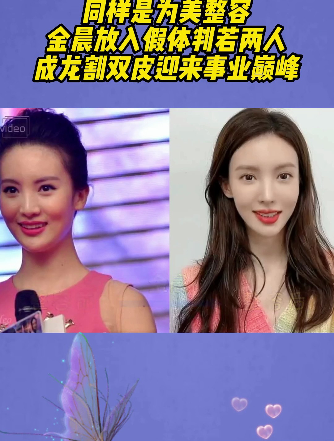 同样是为美整容,金晨放入假体判若两人,成龙割双皮迎来事业巅峰-度小