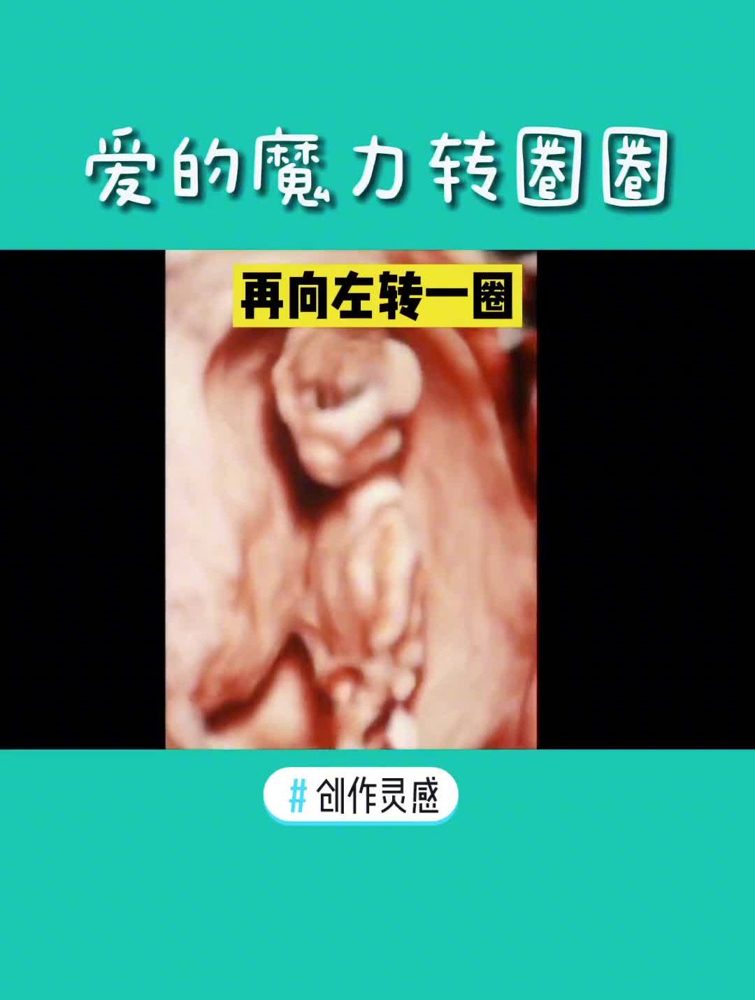 胎儿十一周的样子图片图片