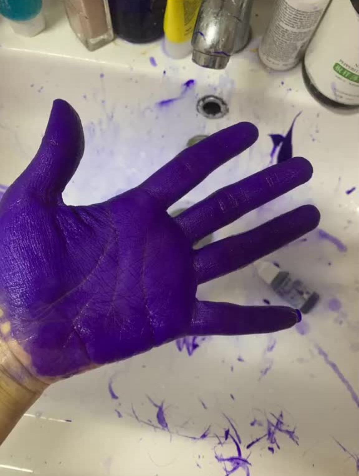 在线等,紫药水怎么才能洗掉啊!紫药水染发-度小视