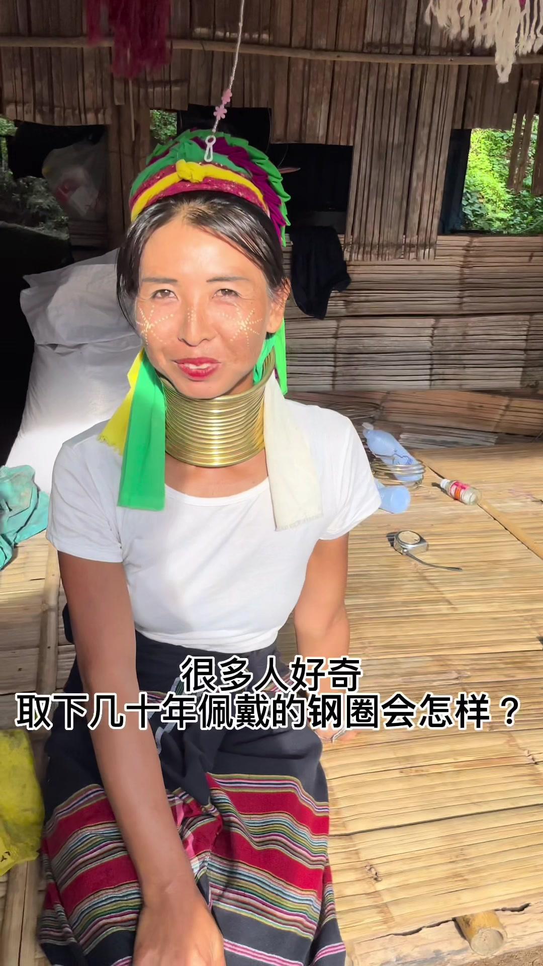 长颈族取下铜环的样子这个视频带大家了解缅甸难民逃到泰国求生