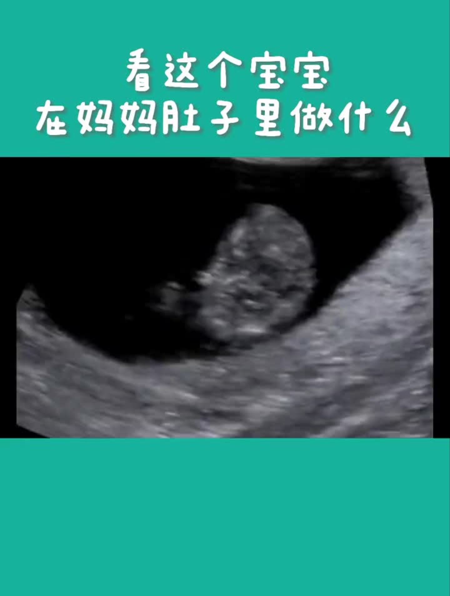 怀孕11周的胎儿图片图片