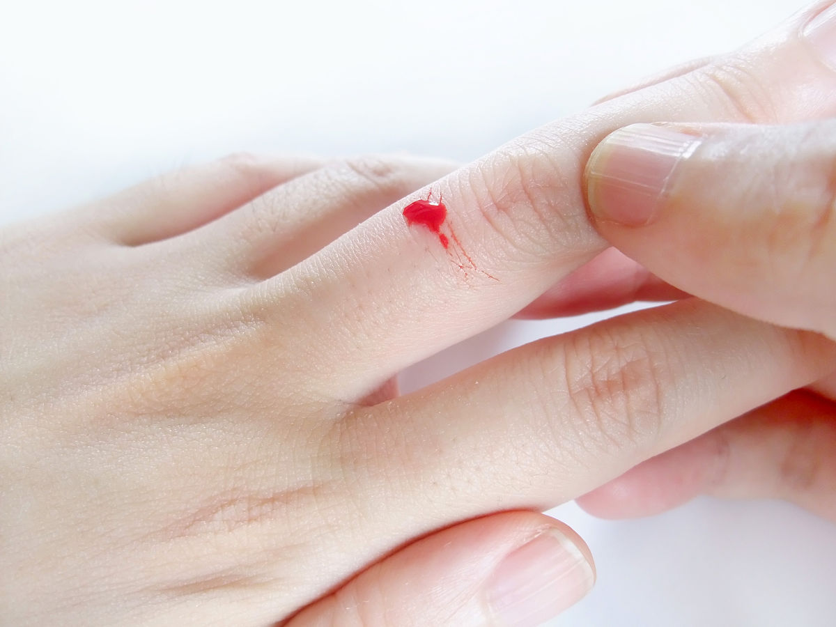 年初三手指头出血是好兆头,好运连连,红红火火,鸿运当头,八方来财