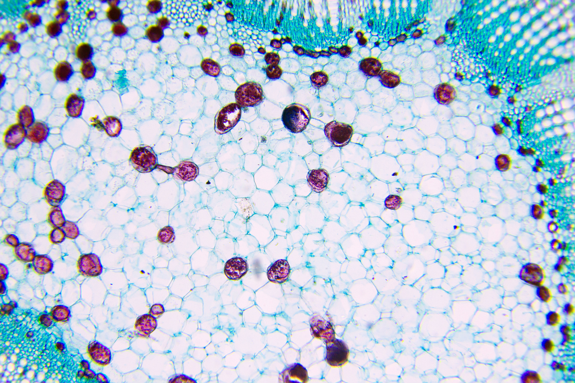 历程 自然杀伤细胞(nk细胞)是免疫系统中一个独特且重要的组成部分