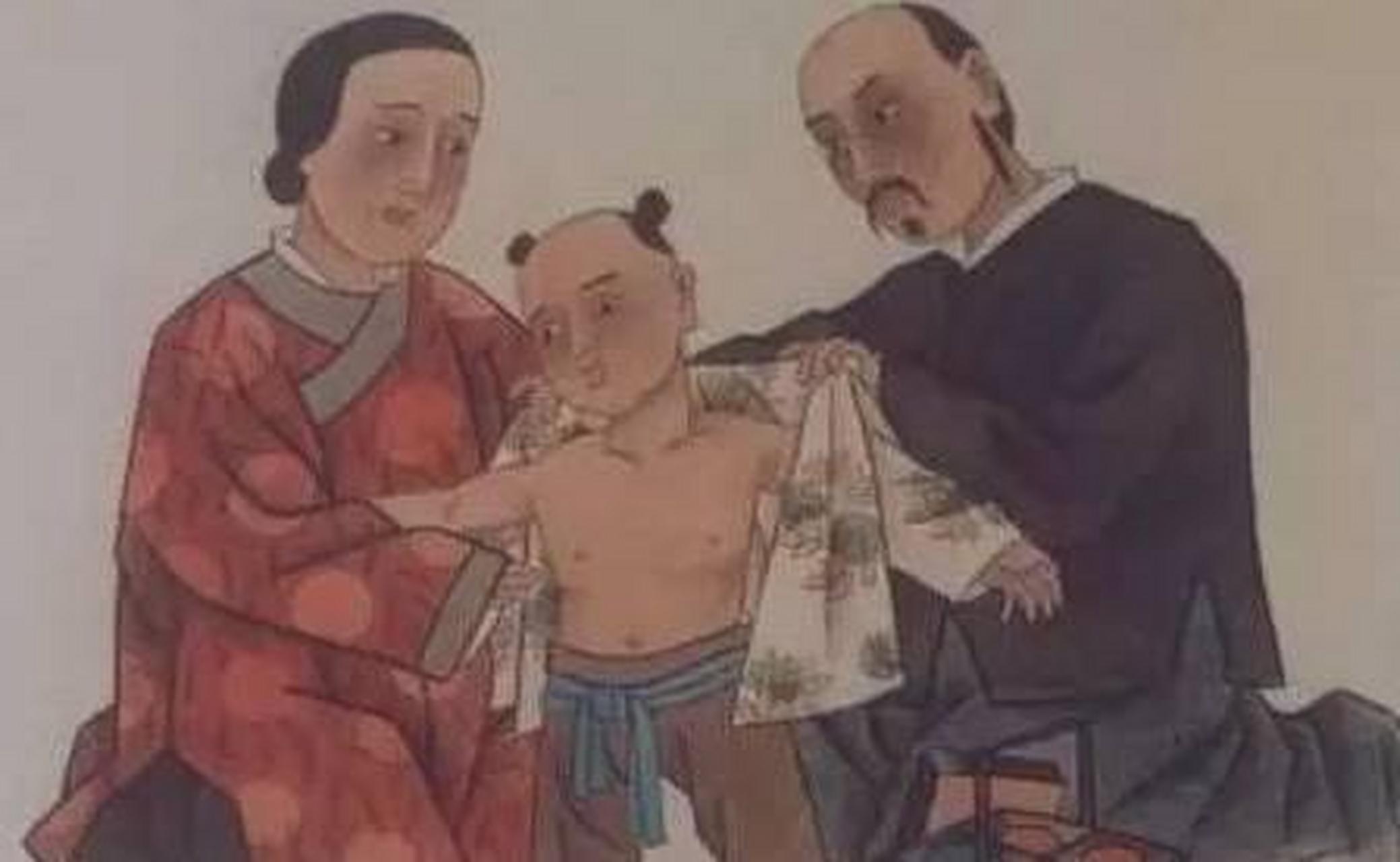 古医书中的"豆疮","疱疮