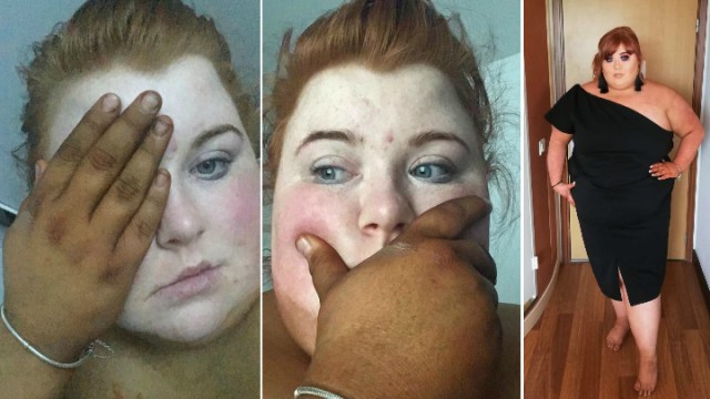 笑翻!女子涂防晒霜时出错,手的颜色比脸黑,朋友误以为她被绑架