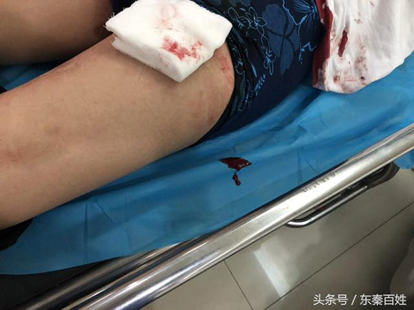 陕西渭南一城管被商贩捅伤腿部,疑占道经营引纠纷,警方介入