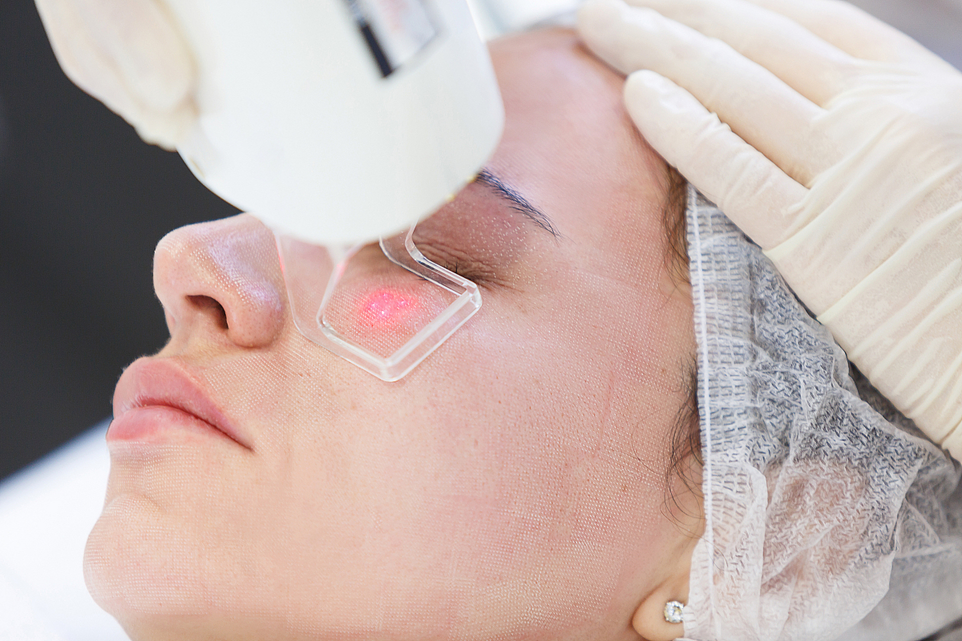 首先,激光美白可以有效减少面部和身体其他部位的色斑.