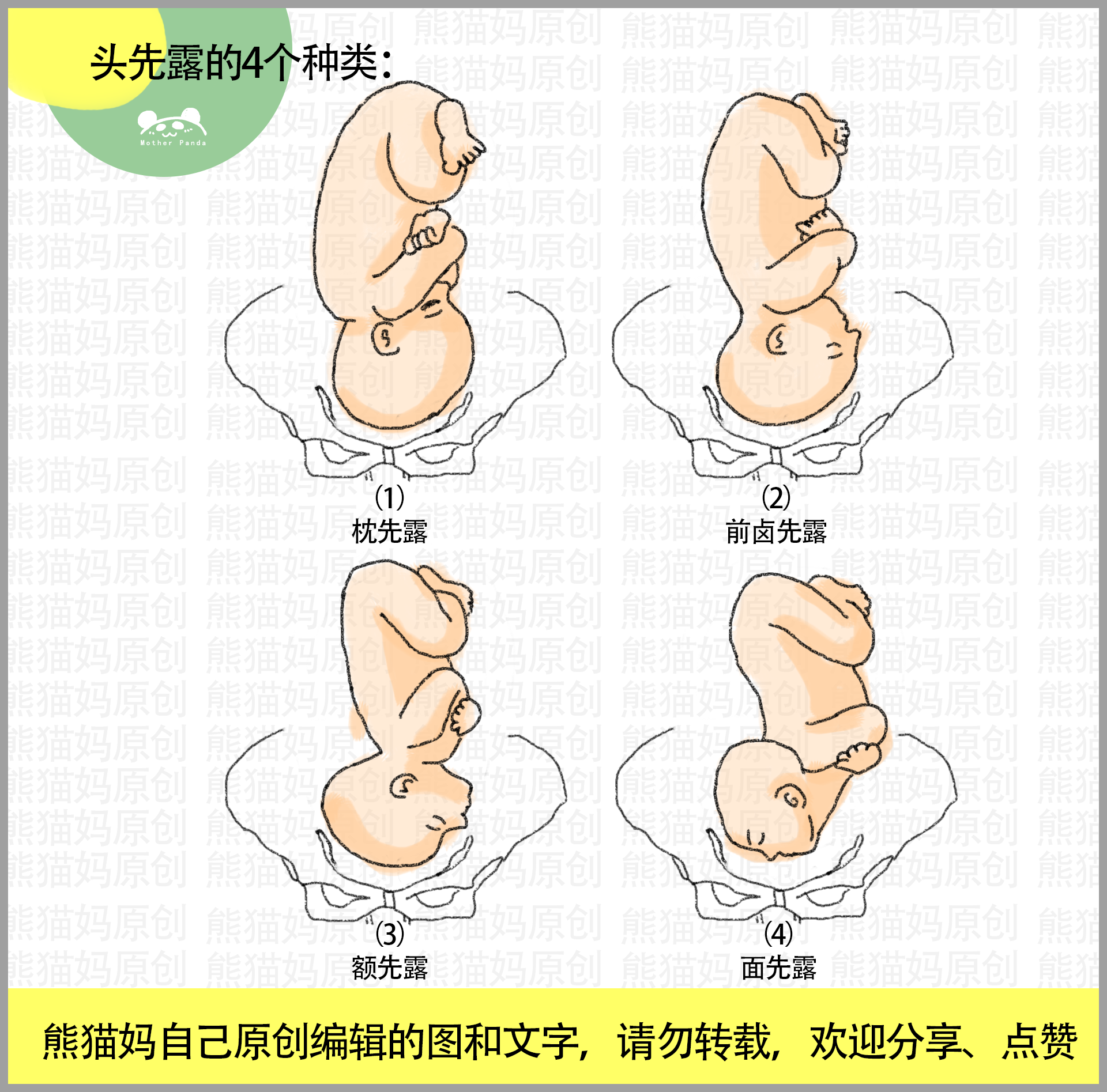 胎位不正11类型图:头先露,臀先露,横产式,斜产式,宝妈