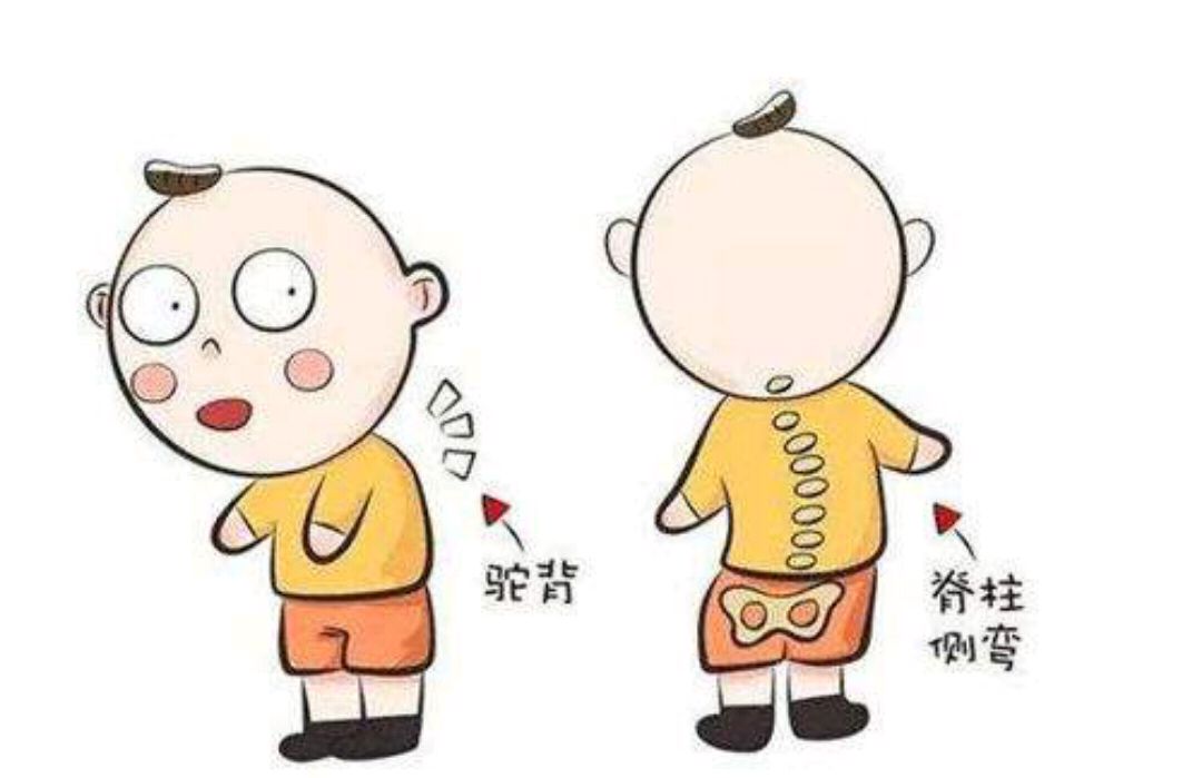 别让你的小孩变成～小驼背