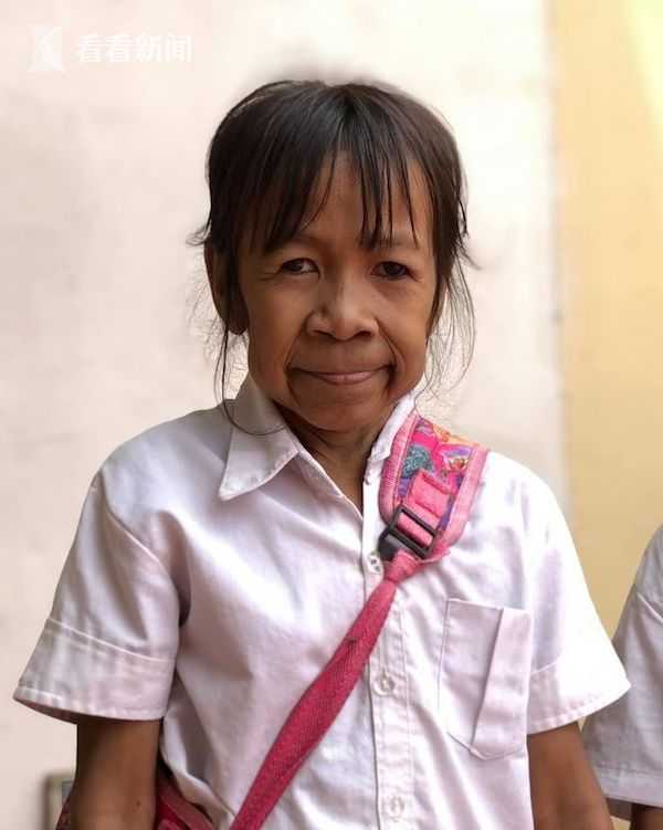 10岁小女孩却衰老如60岁 同学都喊她"老奶奶"