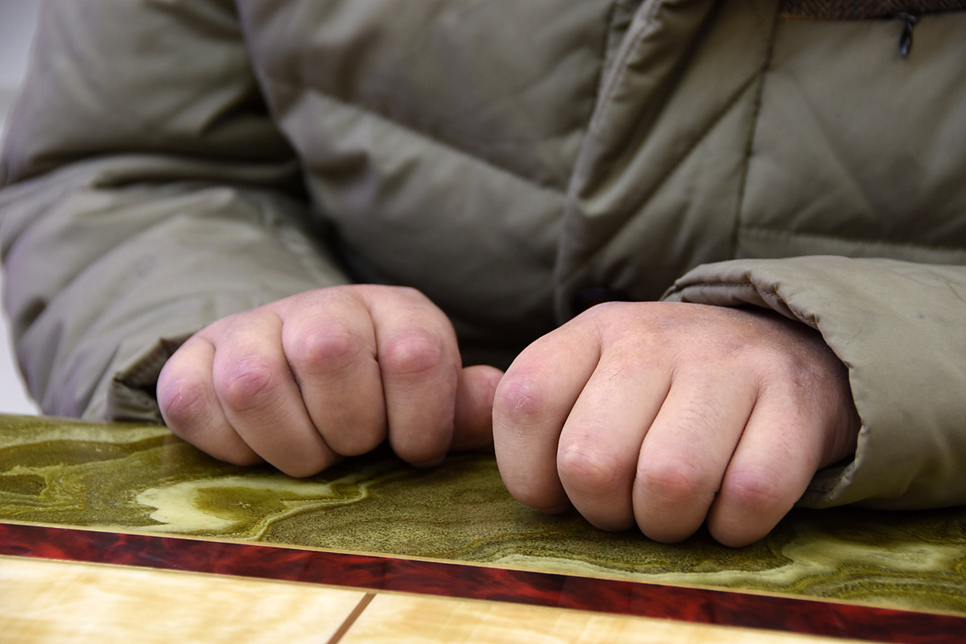 为了与时间赛跑,攻克渐冻症,他及其团队与国内多家顶尖机构合作,已在