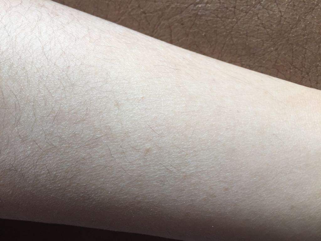 身上有很多"皮屑"是什么原因?做到"这3点",或许能改善!