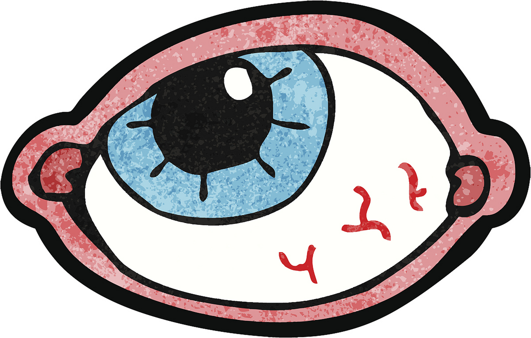 一些人有时候一只眼睛出现红肿像是得了红眼病一样,并且伴随着眼球