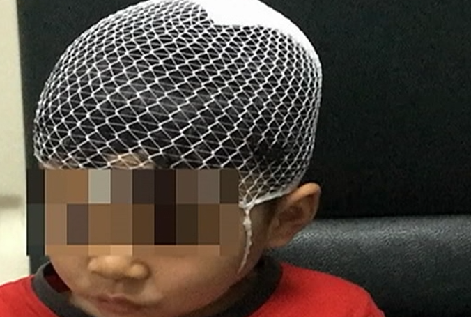 5岁孩童游乐场磕破头,家长索赔数万元,早干什么去了!