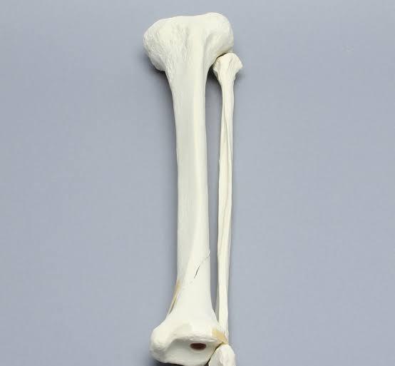 小腿胫腓骨骨折后,医生不急于手术,为什么?术前要注意些什么呢