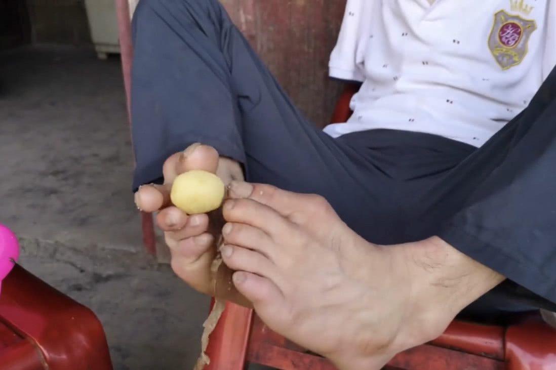 无臂小伙用双脚做油炸土豆,用脚给妈妈盛土豆时,我热泪盈眶