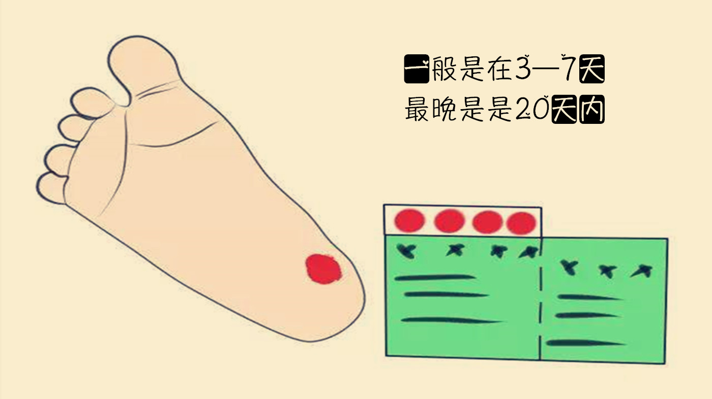 采足跟血的最佳位置图图片