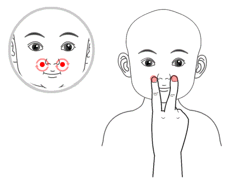 「润朵堂小儿推拿」警惕 宝宝鼻塞流鼻涕