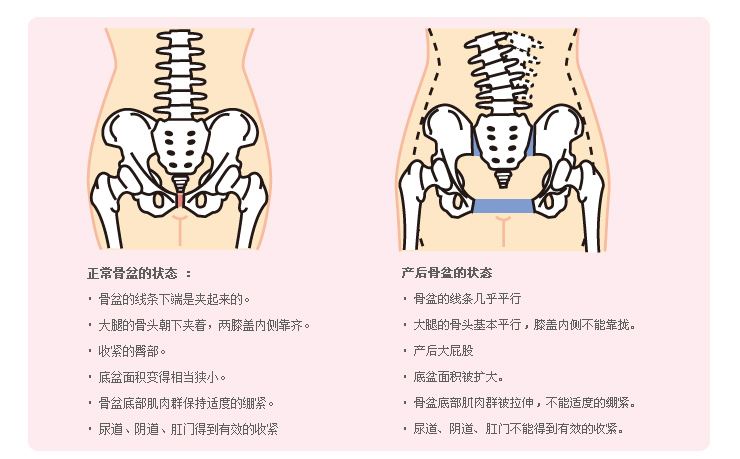 骨盆小生孩子就不能顺产吗?看完这个就知道了