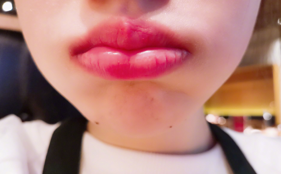 冯提莫吃火锅嘴被辣肿,网友调侃这下省钱了,不用微整就有大红唇