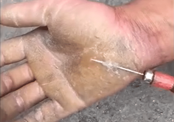 男子工地搬砖十几年,手上老茧针扎不痛,网友:老实人!