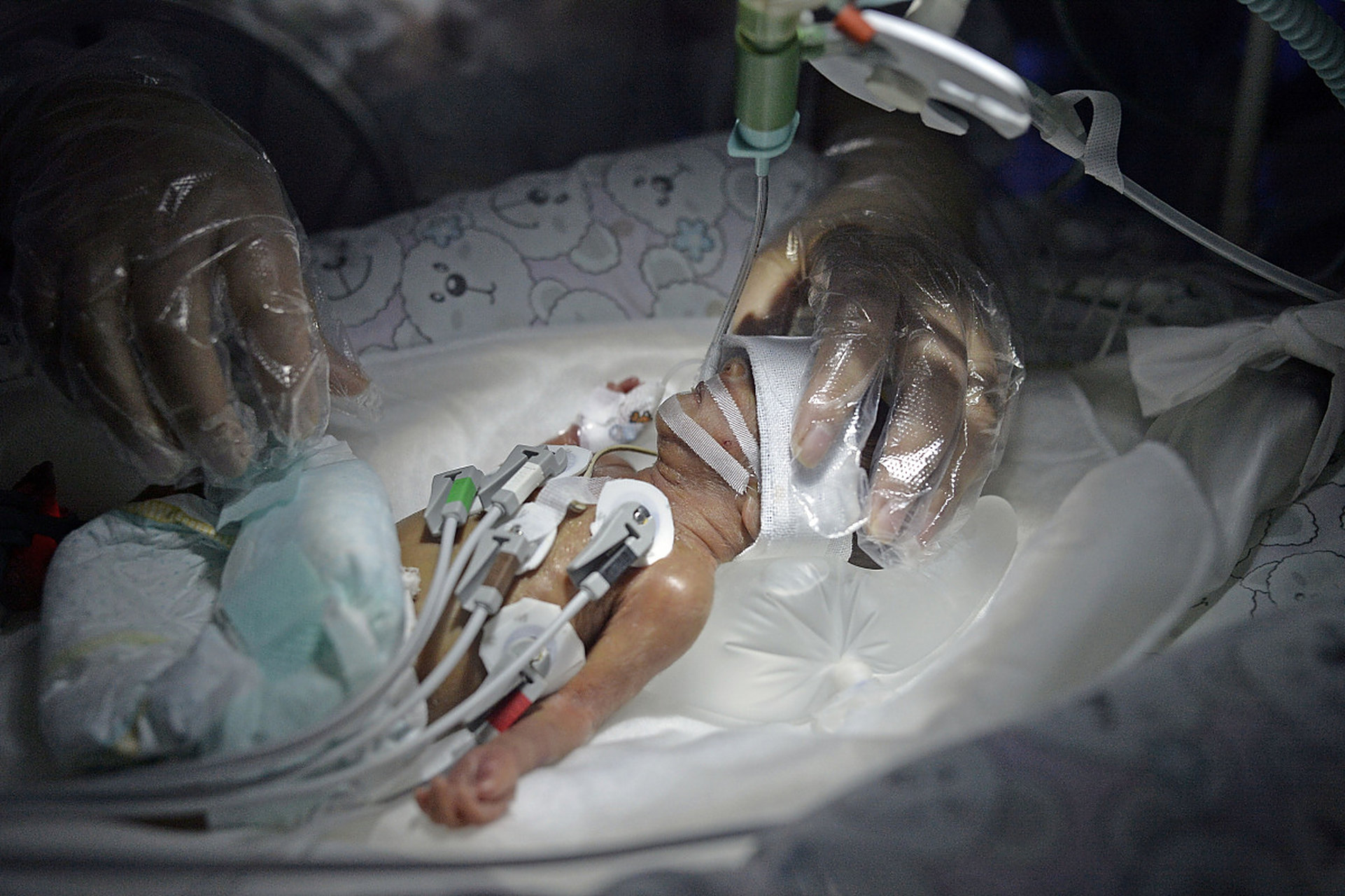 那个被遗弃的女婴,居然在纸条上写着"我无力抚养"!