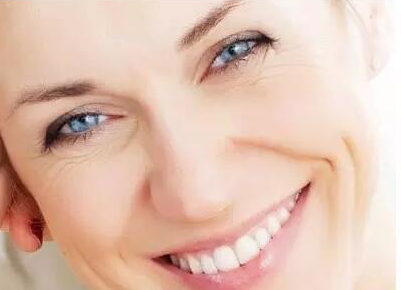 爱笑的女人运气不会太差,法令纹是你不笑的理由?