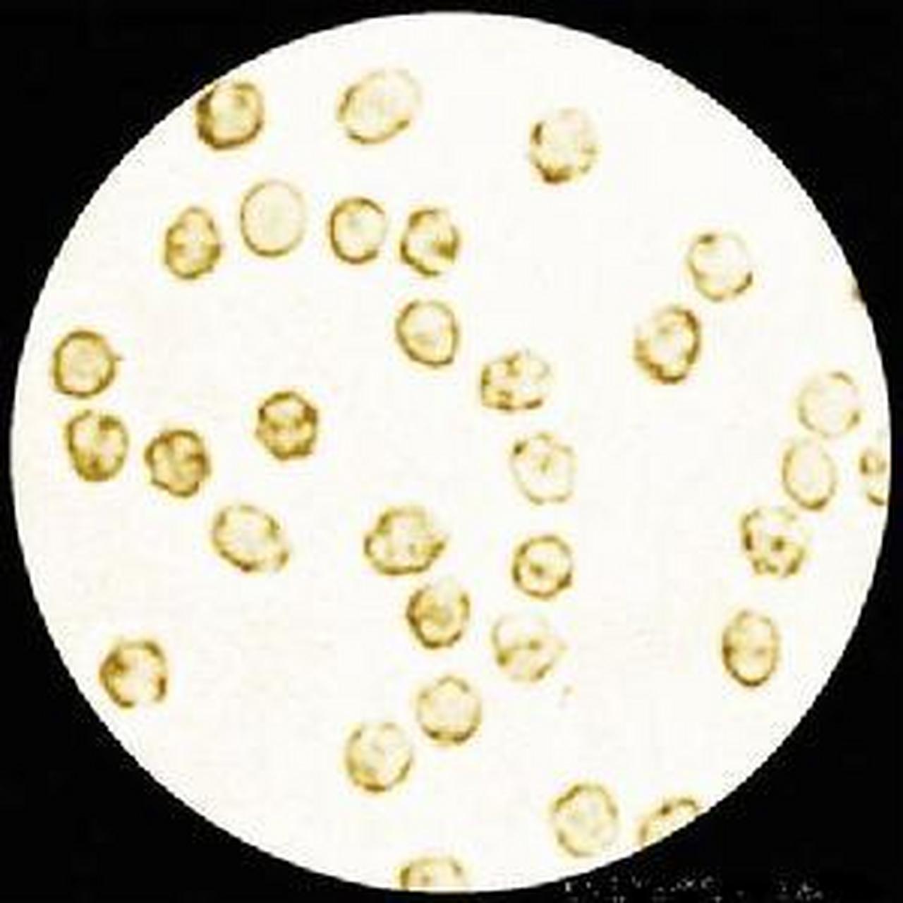 尿红细胞位相检查是利用位相显微镜检查尿中红细胞形态的一种方法