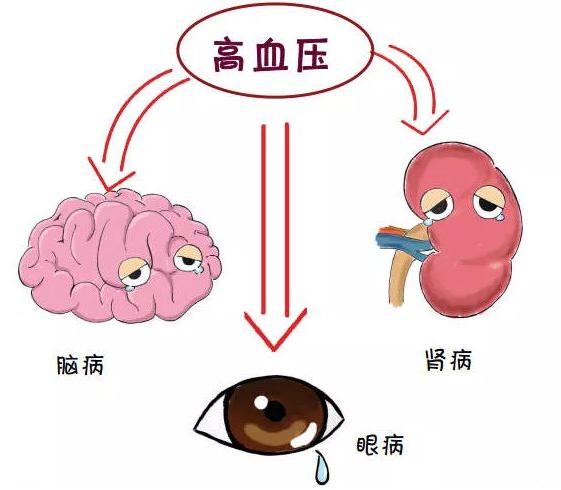 高血壓,高血糖,高血脂是如何