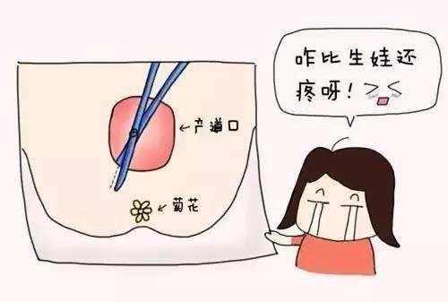为什么生孩子要侧切,侧切的感受大有不同,要顺产的妈妈莫紧张