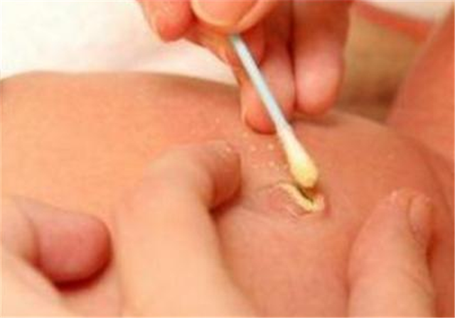 婴儿肚脐自然掉后需要擦碘伏?你或许真的不知道,今天我来告诉你