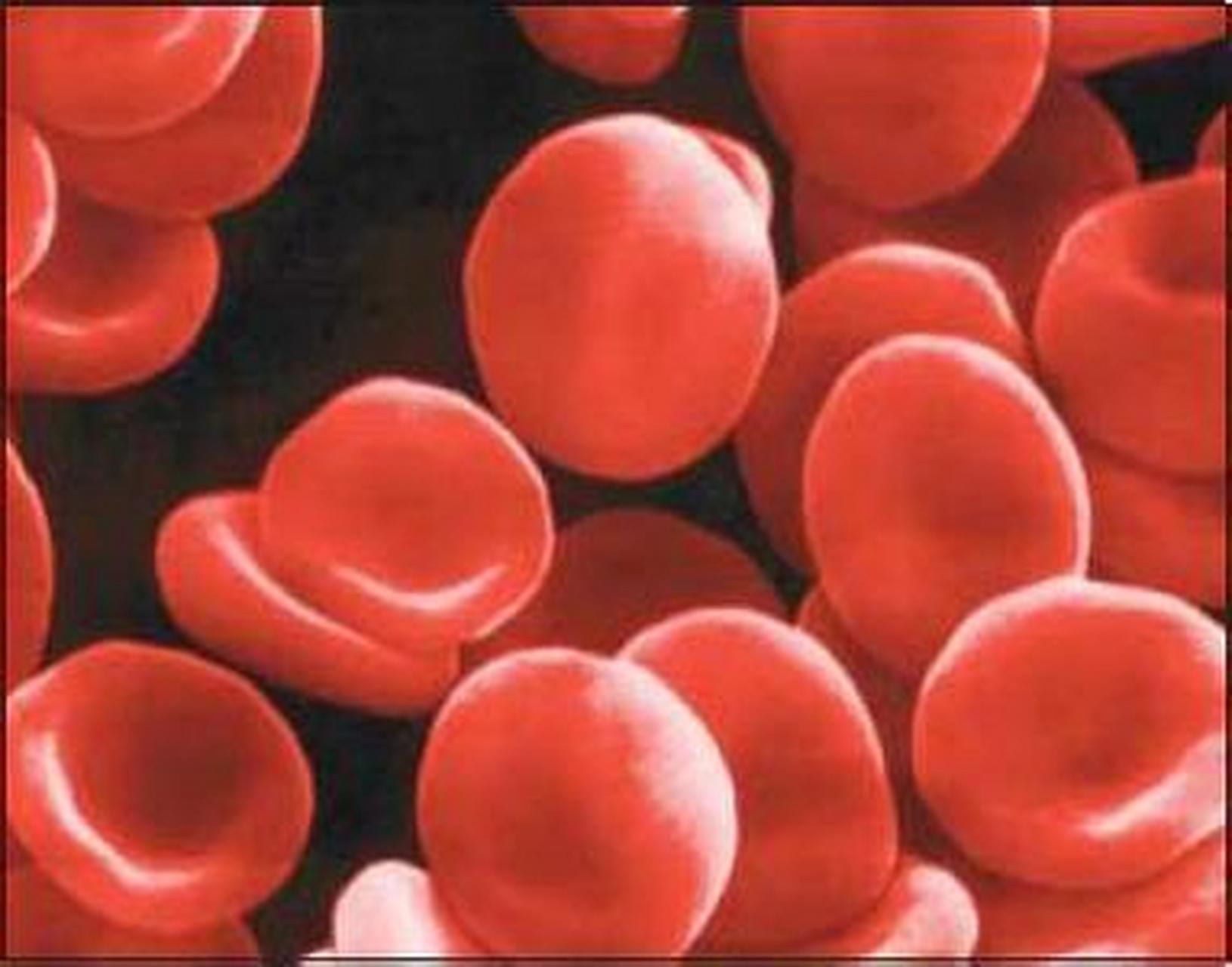 科普知识竞赛#当血管内有大量红细胞破坏,血浆中游离的血红蛋白超过