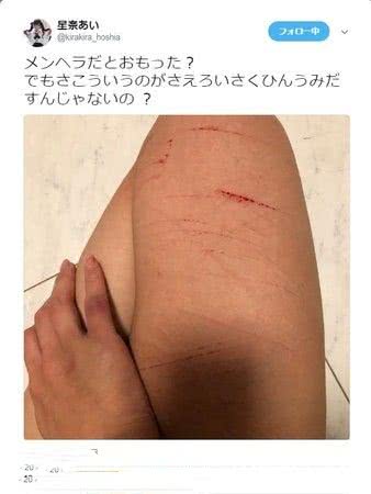 日本某女星为男友做女优,却遭男友背叛,被甩后晒自残照!