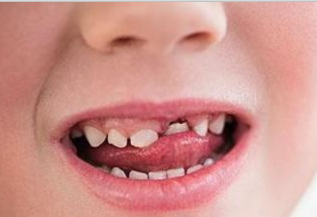 孩子几岁开始换"乳牙"?换牙过早过晚,对孩子发育有影响吗?