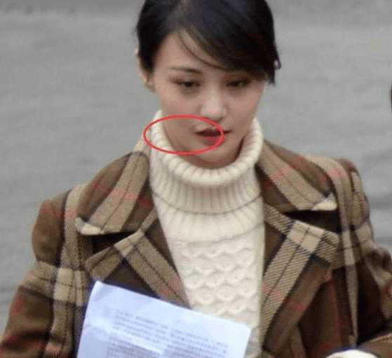 郑爽新剧露透美照持续出炉,可嘴角的伤疤就连化妆都盖不住