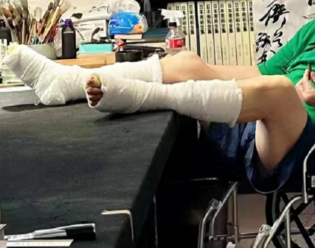 66 岁张铁林近况曝光!双腿缠满纱布,面容苍老满头白发尽显憔悴
