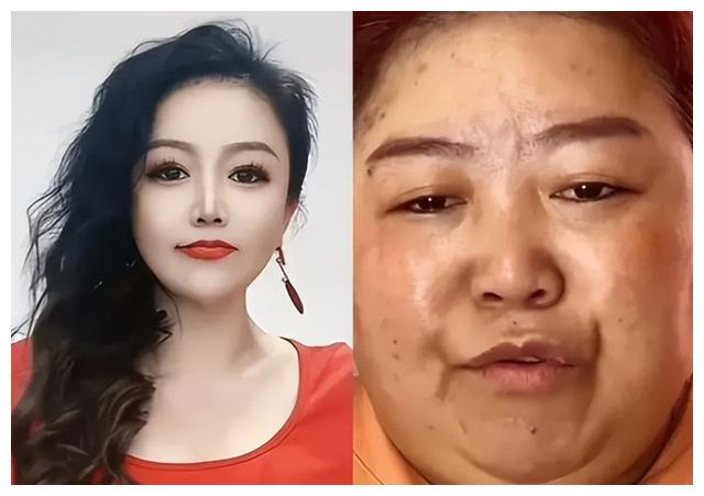 百万网红苹果姐姐花60万打造的脸垮了!果然医美的尽头都是修复
