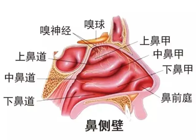 鼻中隔偏曲鼻甲肥大怎么治疗?有经验的医生通常这样做!