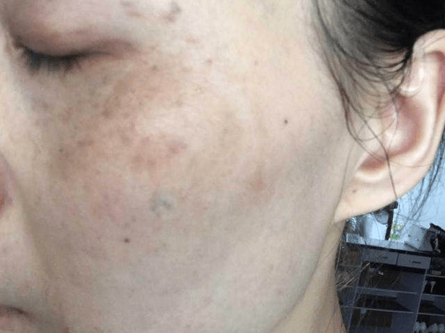 淡斑效果好的护肤品,成功者推荐效果出众的5款护肤品!