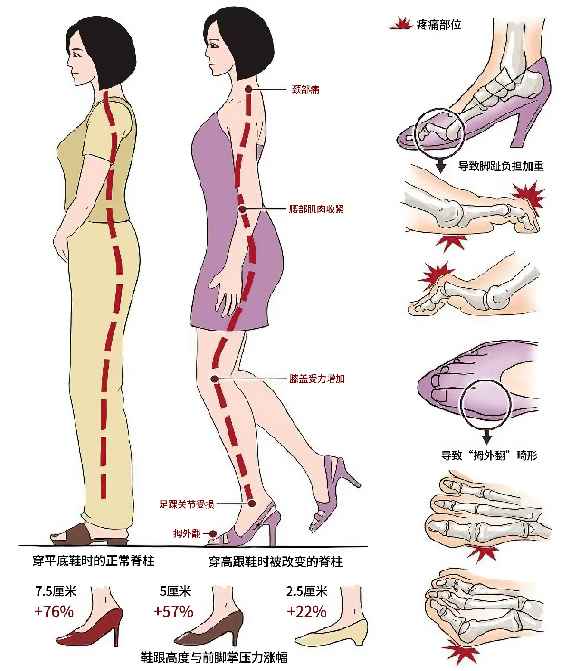 中老年人坚持7点正确走路,保护膝盖健康