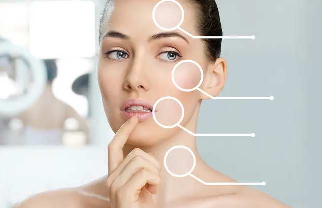 镭射净肤可以改善哪些皮肤问题?做完后皮肤会返黑吗?