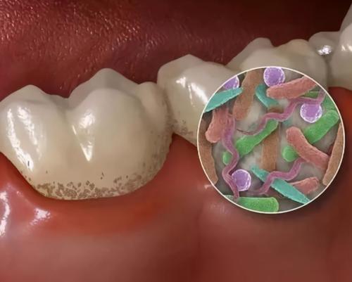 口罩就快摘掉了,还不注意你的口腔卫生吗?