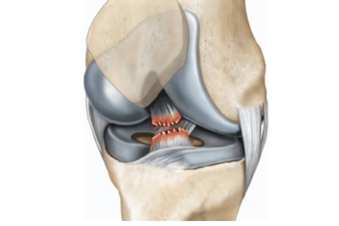 前交叉韧带损伤解剖,症状,功能,治疗及康复,一文讲清!