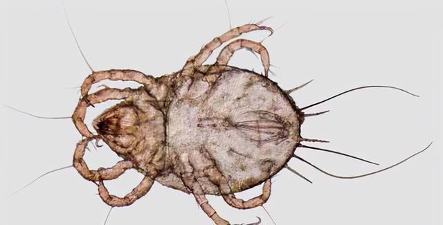 九成人不懂螨虫最怕的是啥?教你一个"小笨招",床上"无螨虫"