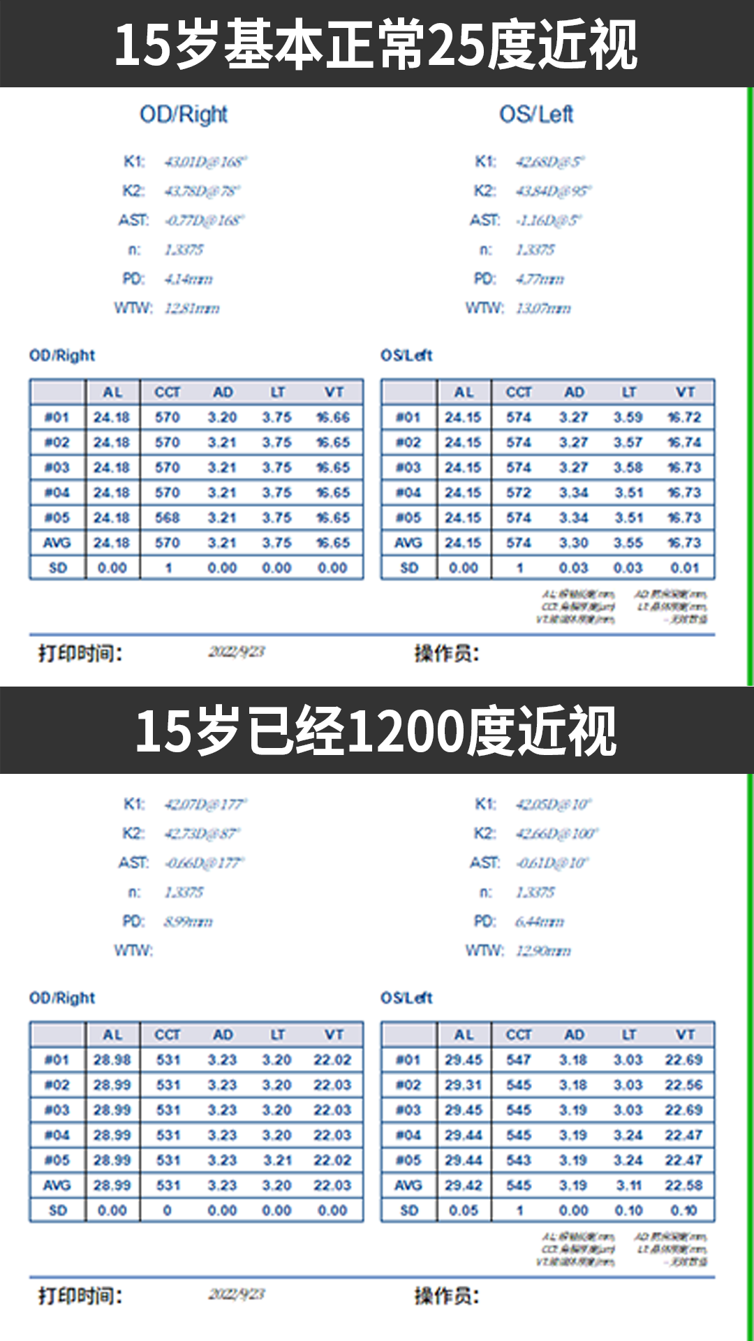 孩子4岁,近视1000度,听到这个几个词,您脑中是什么画面?