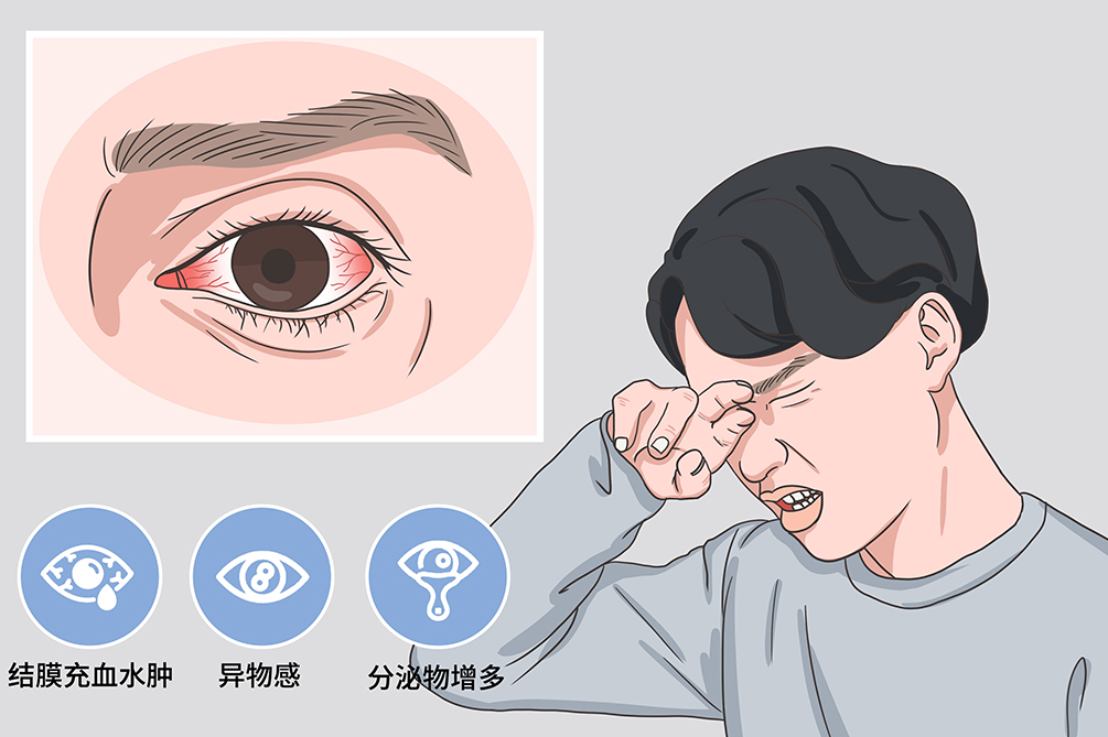 眼部肿胀?可能是眼睑炎