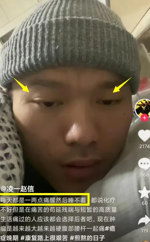 27岁网红凌一去世,为省钱不化疗只吃中药,其主治医生遭网暴